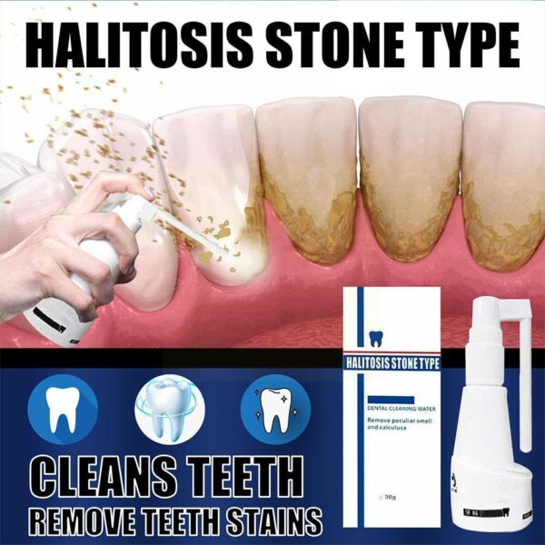 Dental Calculus Cleaning Halitosis Stone Type Remove Teeth Whitening Dental Cleaning Water Remove Peculiar Smell and Calculus