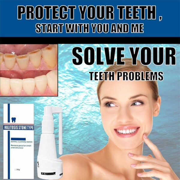Dental Calculus Cleaning Halitosis Stone Type Remove Teeth Whitening Dental Cleaning Water Remove Peculiar Smell and Calculus - Image 2
